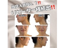 ルルアス(LUluas)