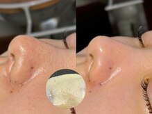 ルーナジェーナ(Luna llena)/池袋　エステ　ルーナジェーナ