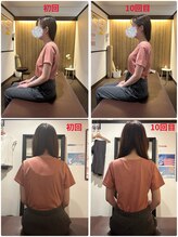 サクラ(SAKURA)/【30代】BeforeAfter