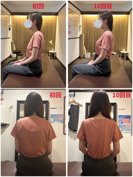 サクラ(SAKURA)/【30代】BeforeAfter