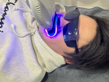 シード(SHE°)/セルフホワイトニング