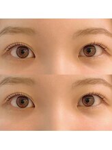 ユーロ(EURO)/ラッシュリフトデザイン♪