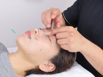 ヴォラーレ 所沢駅店(Volare)の写真/【鍼灸・美容鍼・骨盤矯正・腰痛改善整体】身体の不調改善に◎お客様に応じたオーダーメイド施術