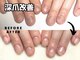 プラスワン(+1)の写真/【もっと早く来ればよかった…】深爪,巻き爪のコンプレックスは＋1で解消♪自爪育成で美しい指先、足先に☆