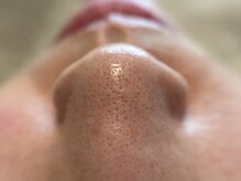 リセットプラス(Reset+)/