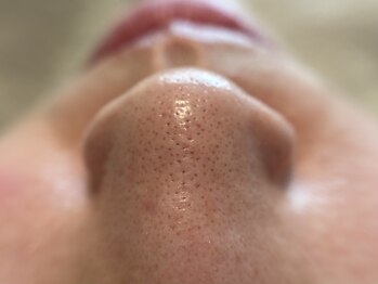 リセットプラス(Reset+)/