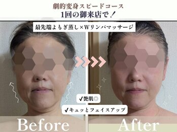 ヨサパーク アエル(YOSA PARK AELL)/１回で！よもぎ蒸し/小顔/むくみ