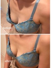 プリマベラ 花隈店(Primabella)/バストアップ☆ビフォーアフター