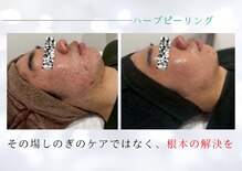 ユアーズ ビューティー(YOURS beauty)