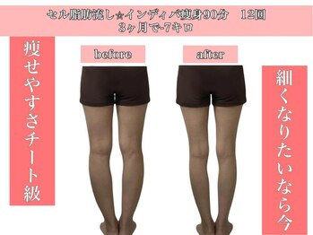 エステサロン ヴリエ 立川店/3ヶ月-7キロ★痩せやすさ桁違い