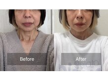 ハッピービューティーサロン じゆう(Happy Beauty Salon J∞YOU)/魔法のミラクルリターンフェイス