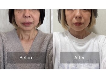 ハッピービューティーサロン じゆう(Happy Beauty Salon J∞YOU)/魔法のミラクルリターンフェイス