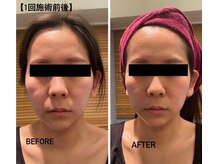 ルナグランデ(Luna grande.)/驚きの変化！！