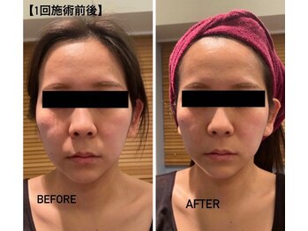 ルナグランデ(Luna grande.)/驚きの変化!!