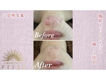 アマテラス 原宿店の雰囲気（長年のお悩み【美白/くすみ/シミ/肝斑にもめちゃ効果大★】）