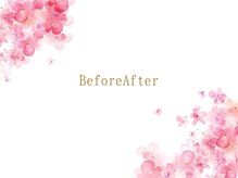 サクラ(SAKURA)/BeforeAfter