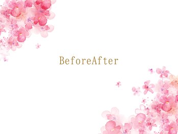 サクラ(SAKURA)/BeforeAfter