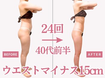 べモーレ 上本町 谷町九丁目(Bemolle)/40代痩身24回ビフォーアフター☆