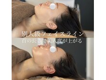 ジャスミン(Jasmine)の雰囲気（プロの頭蓋骨小顔矯正で、引き締まった美しい理想の小顔を実現！）