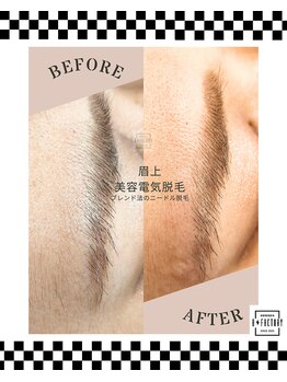 ビー ファクトリー(B FACTORY)/眉周り