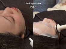 マウ(Mau)/シミケア