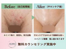 アルモ(ALMO)