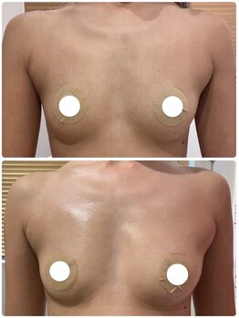 ルナグランデ(Luna grande.)/最新豊胸エステ