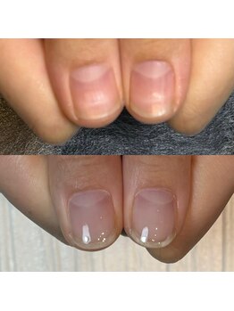 キュア(Cure.)/自爪育成ジェル2回目のご来店