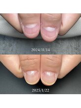 ココ(COCO)/お客様に寄り添う深爪改善