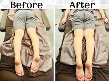 リストアハート(Restore Heart)/骨盤矯正