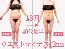 べモーレ 上本町 谷町九丁目(Bemolle)/40代痩身18回ビフォーアフター☆