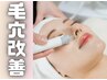 人気No2♪肌質改善＆毛穴ケア【白玉ピール+毛穴洗浄】黒ずみ・角栓もスッキリ