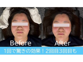 もみほぐしソルブ(もみほぐしSolve)/小顔矯正