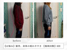 レッド(RED)/姿勢を整えて背中華奢見え