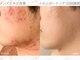 アクール(Accueil)の写真