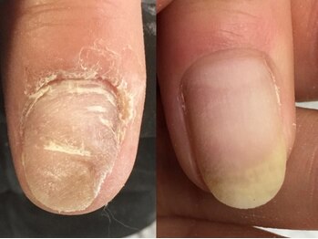 心花ネイルの写真/ケアメニュー充実！角質ケアや巻き爪ケア、フォルム調整も人気★オフィス・プライベートで魅力的な指先を◎