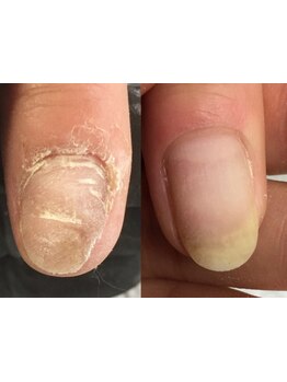 爪の悩みを解消できる（ケア含む）