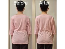 肩の高さが整い、全身の歪みがすっきり姿勢改善♪印象が違います