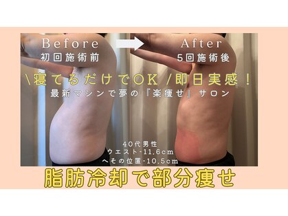 レパードの写真