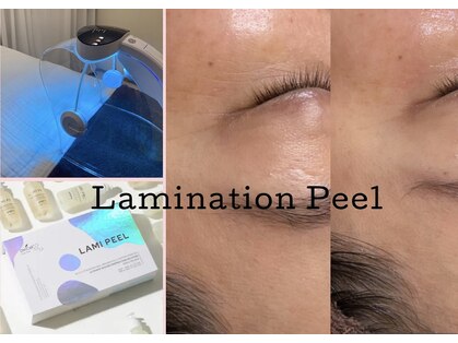 グレイスシャイン(GraceShine)の写真