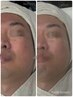 【美容施術後の赤み*乾燥ケアに】ダウンタイム専用アンストレス