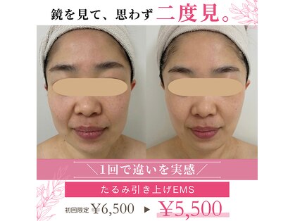 米子美人の写真