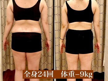 サロン セドナ(SALON SEDONA)の写真/【豊田市｜短期集中痩身】３ヶ月後鏡を見るのが嬉しくなる◎　綺麗に痩せて人生が変わるダイエットになる◎