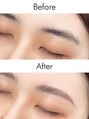 アイム 自由が丘店(i’m) 【Before→After】