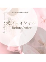 美バリ 新宿店(美BARI)/お肌ケア