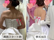 優子さんの美容矯正サロンの雰囲気（天使の羽クッキリ!背中のもたつき肉撃退!（池袋ブライダル痩身））