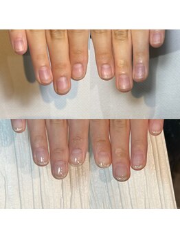 キュア(Cure.)/自爪育成ジェル2回目のご来店