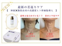 トータルエステサロン ラ ブリーレ