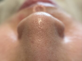 リセットプラス(Reset+)/