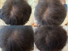 フェイシャルサロン アリイ(ALII)/